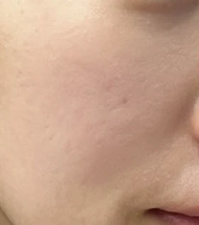 before_image
