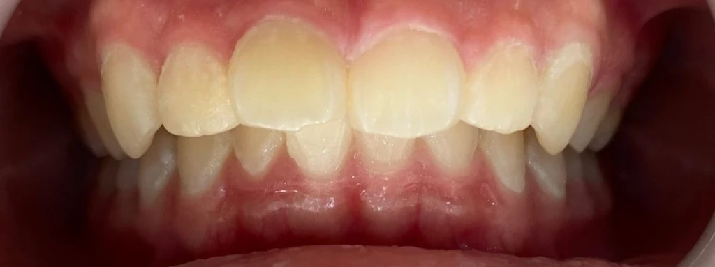 before_image