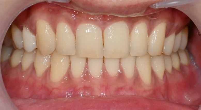 before_image