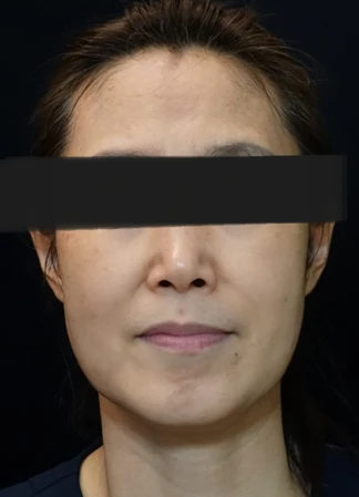 before_image