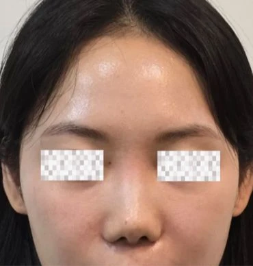 before_image