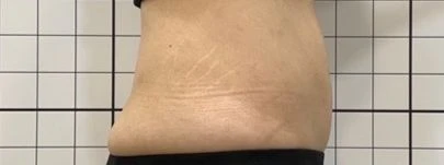 before_image