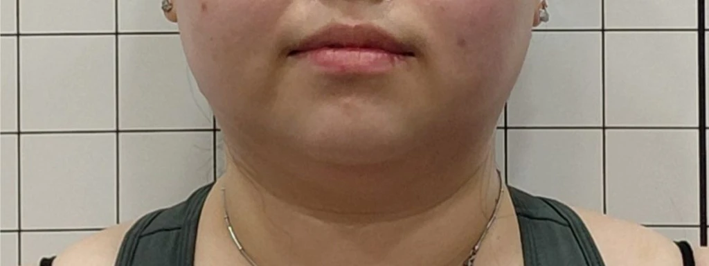 before_image