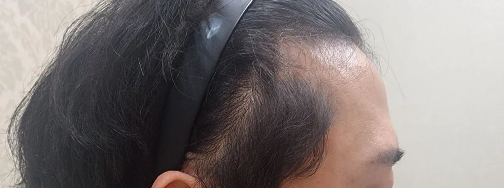 before_image
