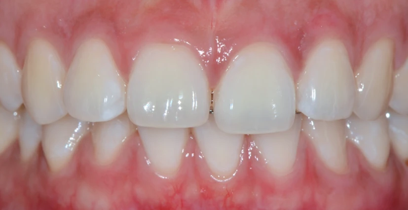 before_image