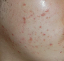 before_image