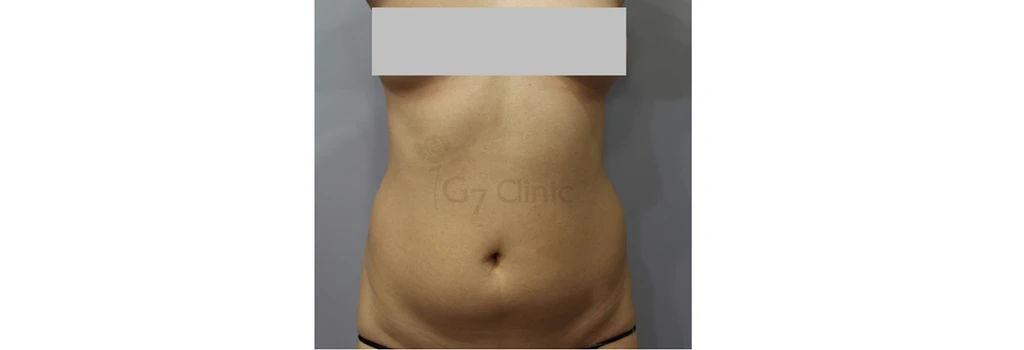 before_image