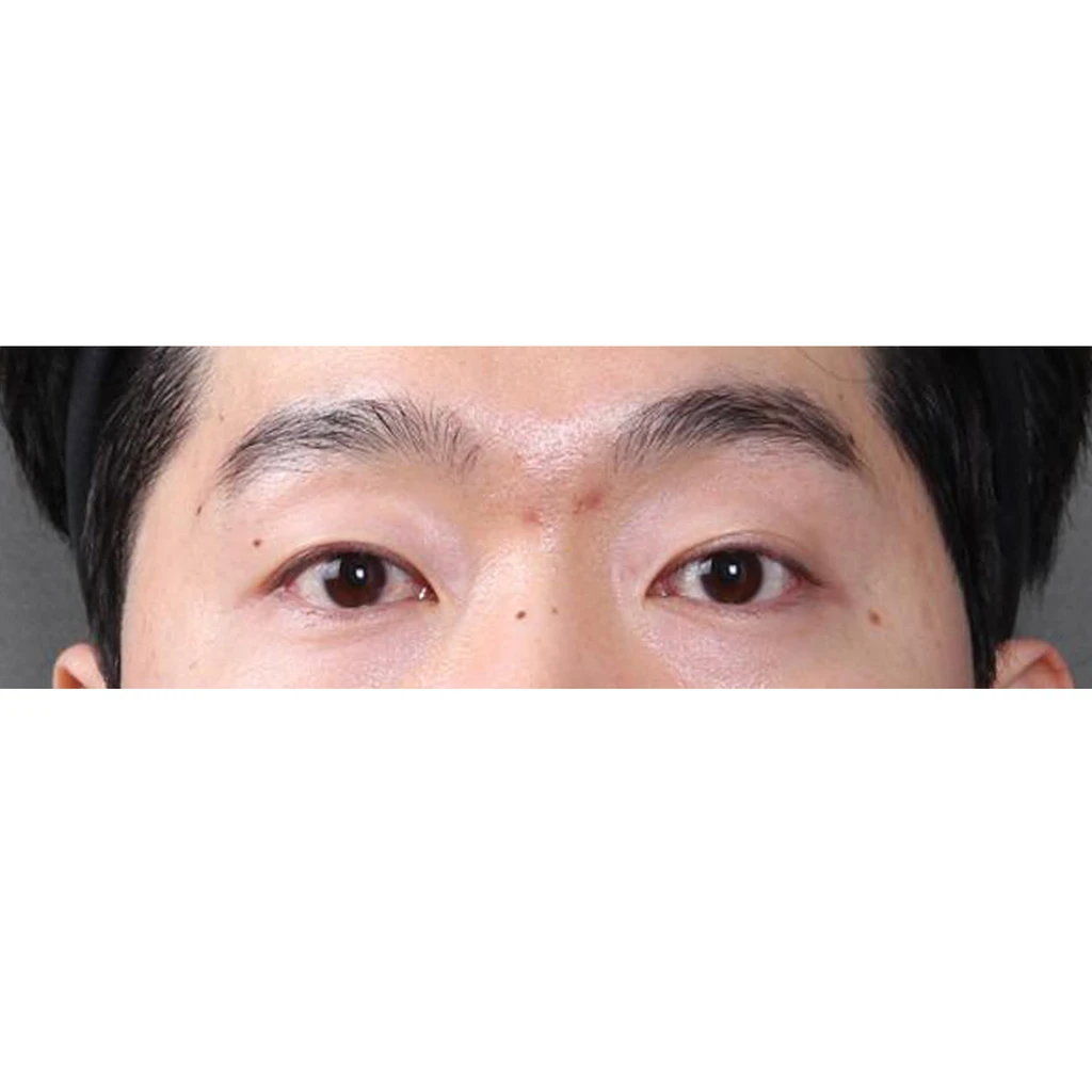 before_image