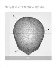 before_image