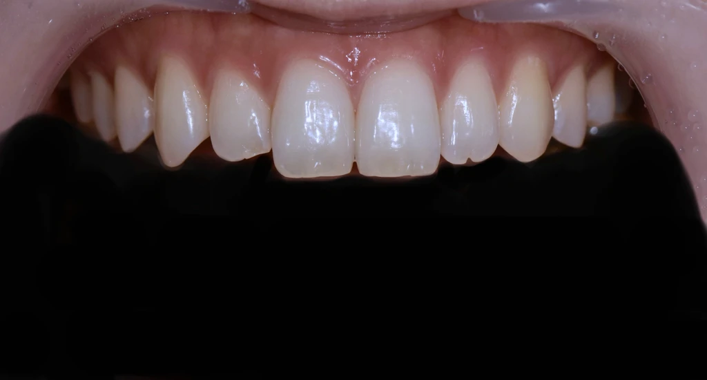 before_image