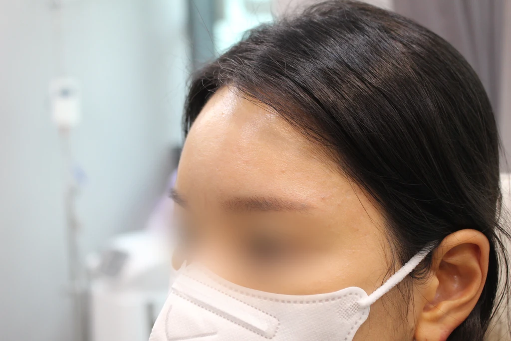 before_image