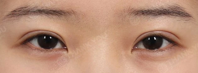 before_image