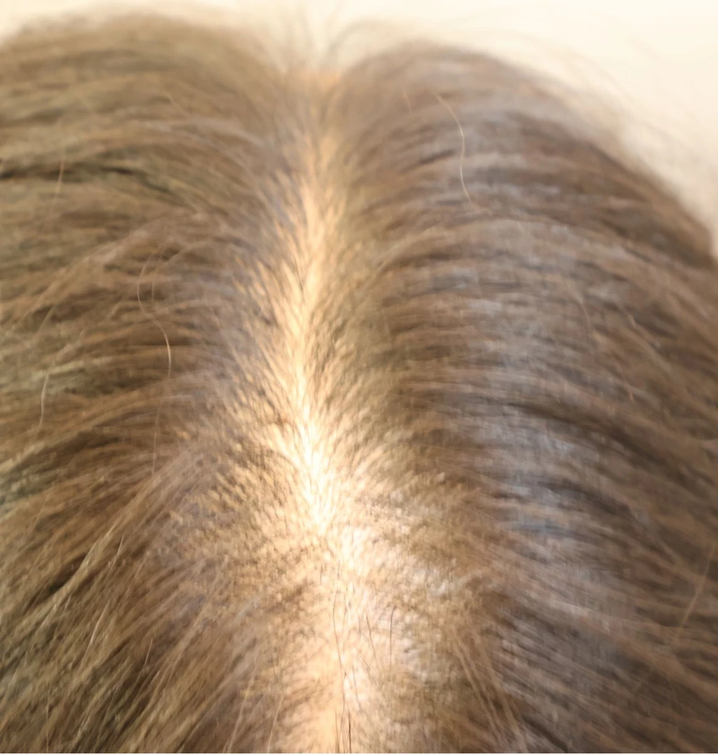 before_image