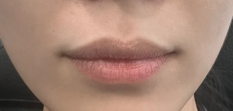 before_image