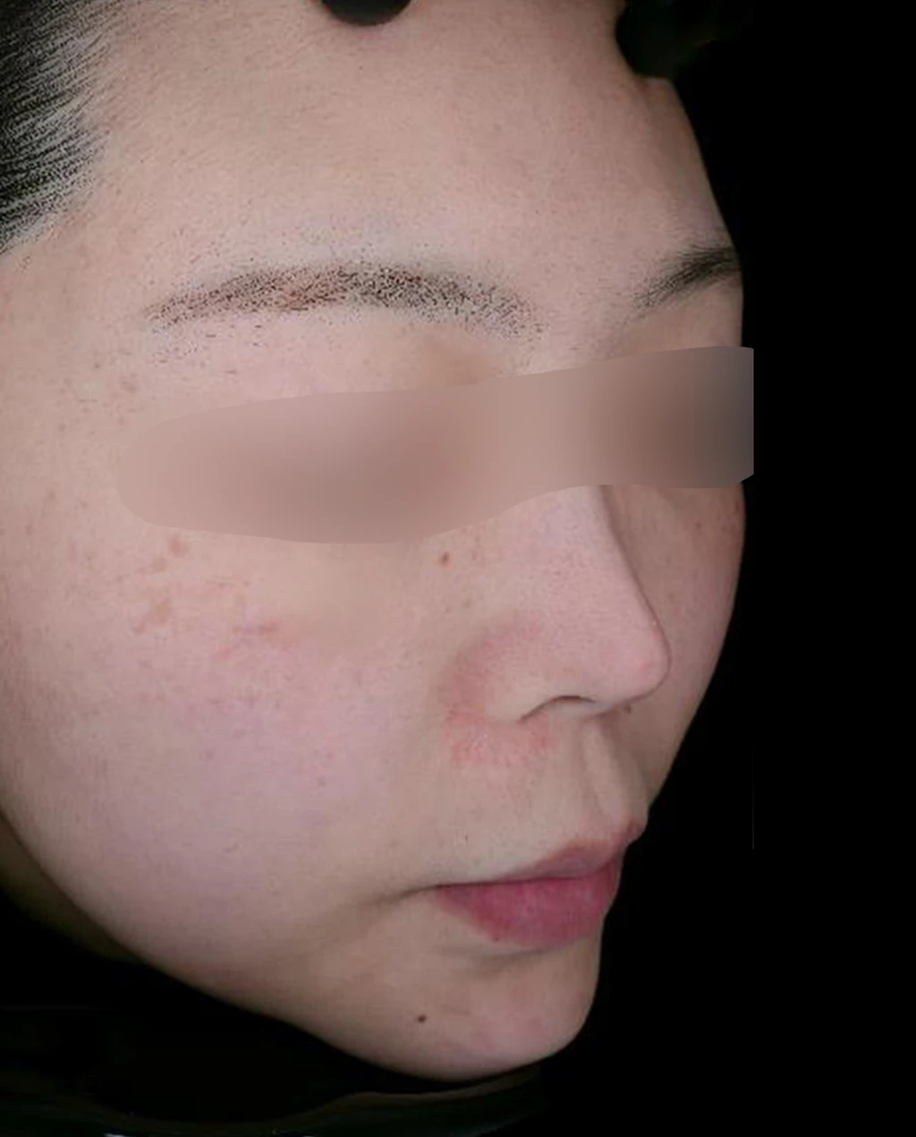 before_image