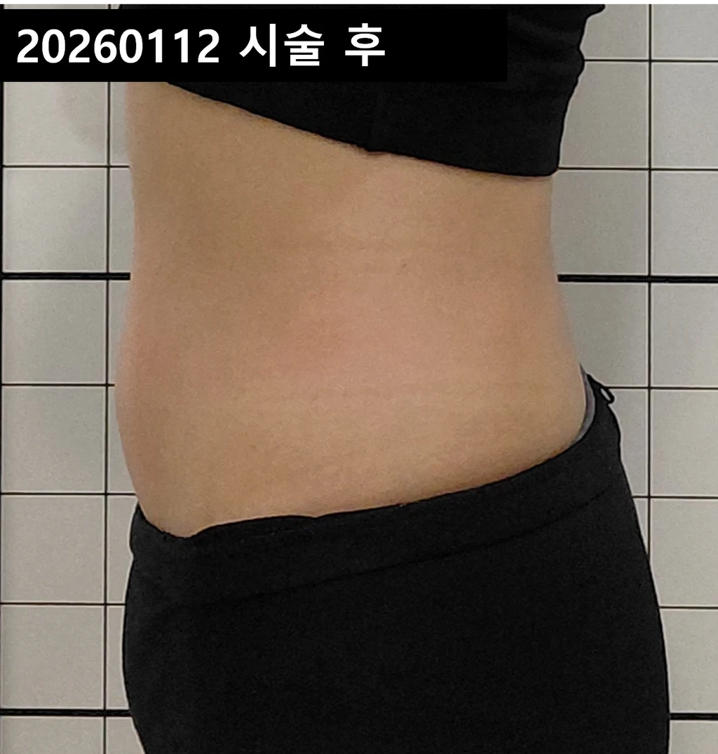 before_image