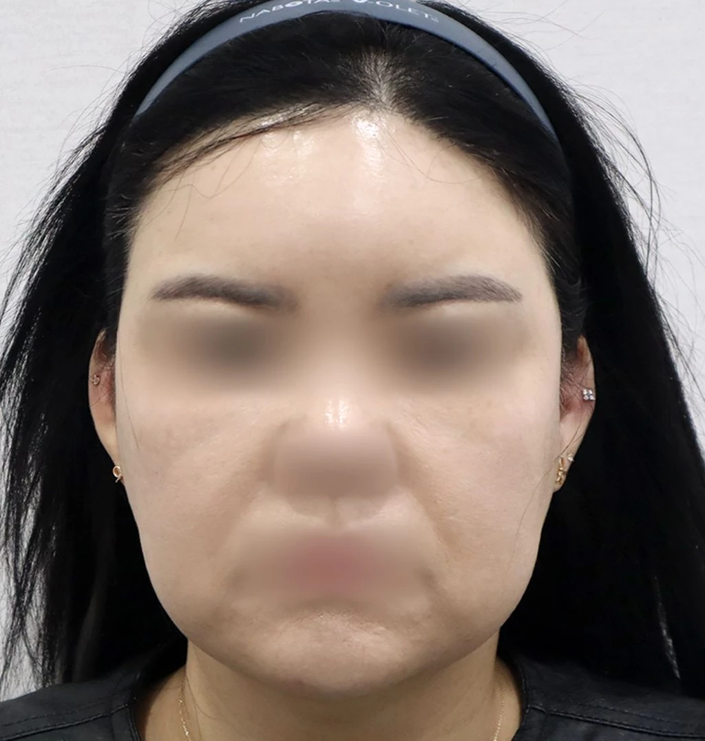 before_image