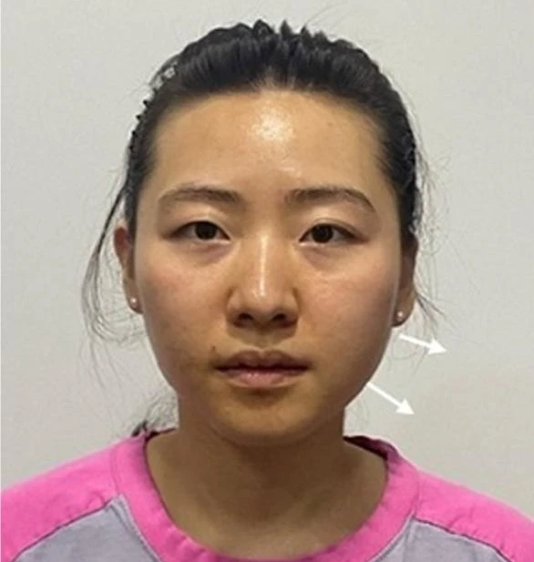 before_image