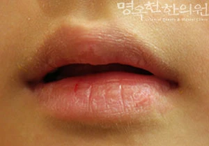 before_image
