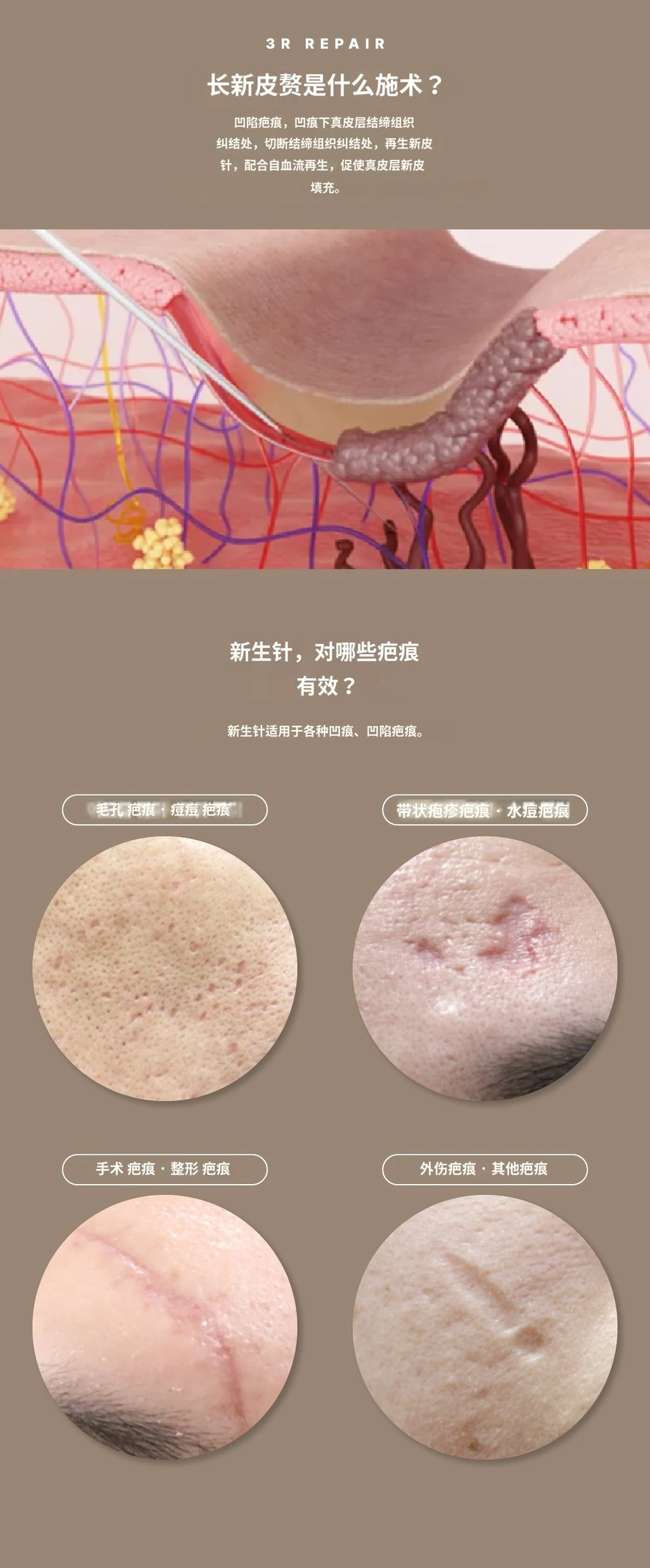 treatmentIntroduction