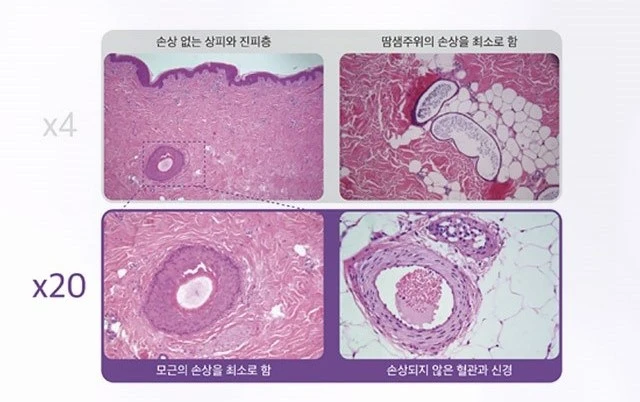 treatmentIntroduction