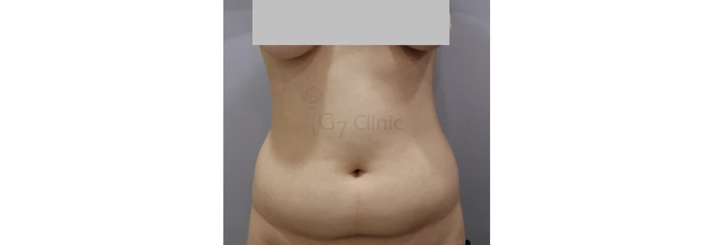 before_image