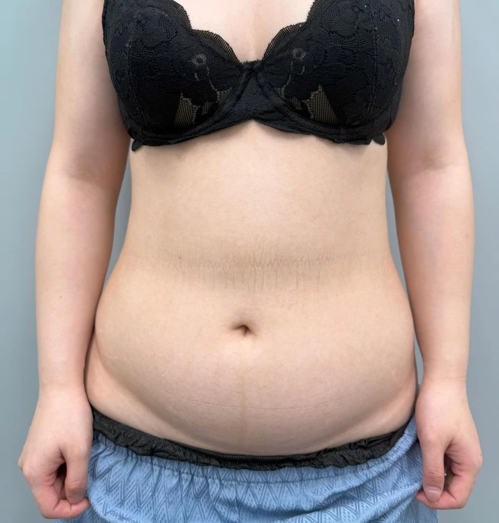 before_image