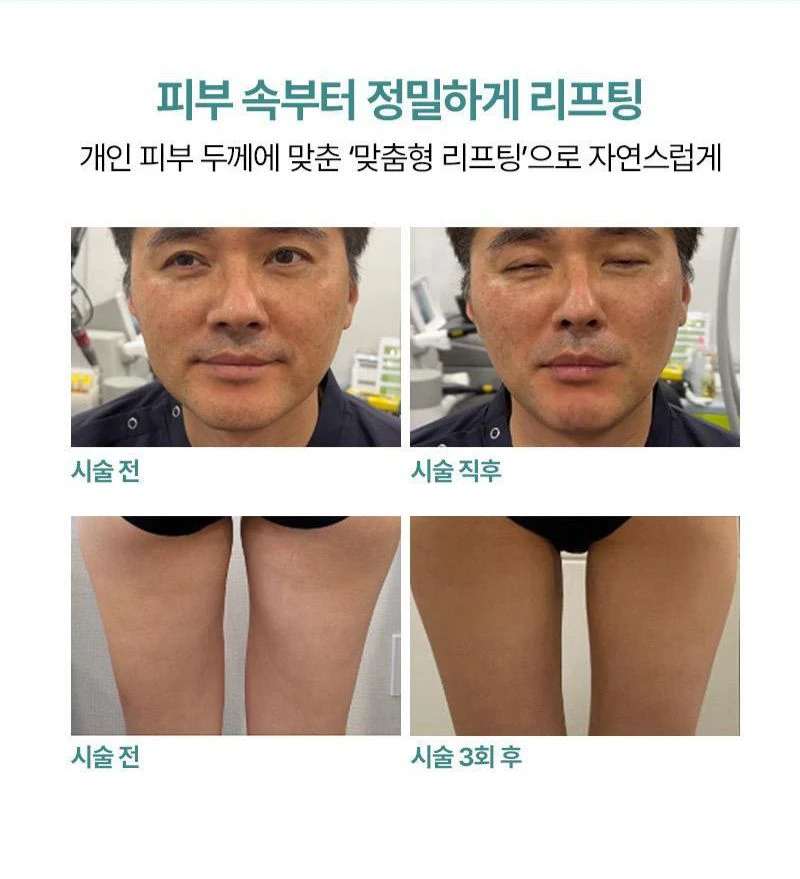 treatmentIntroduction