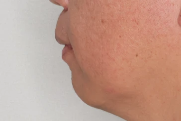 before_image