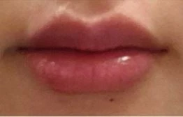 before_image