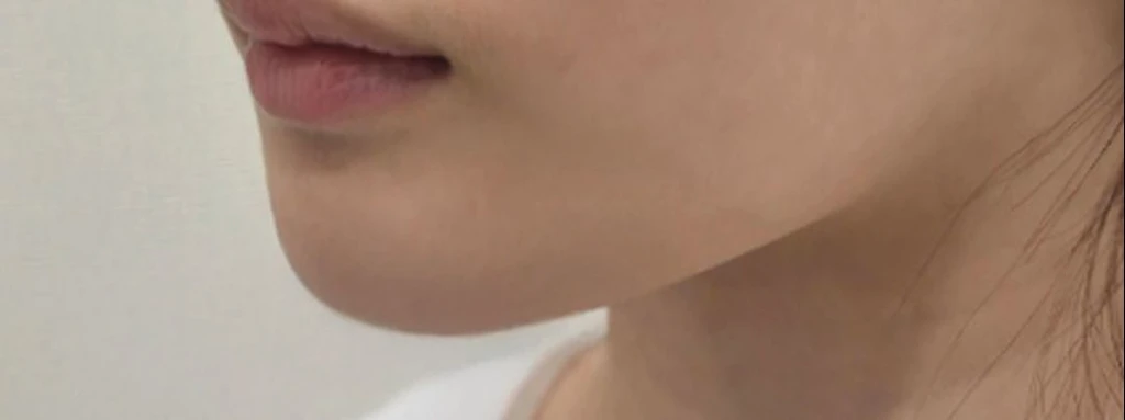 before_image
