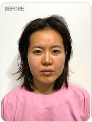 before_image