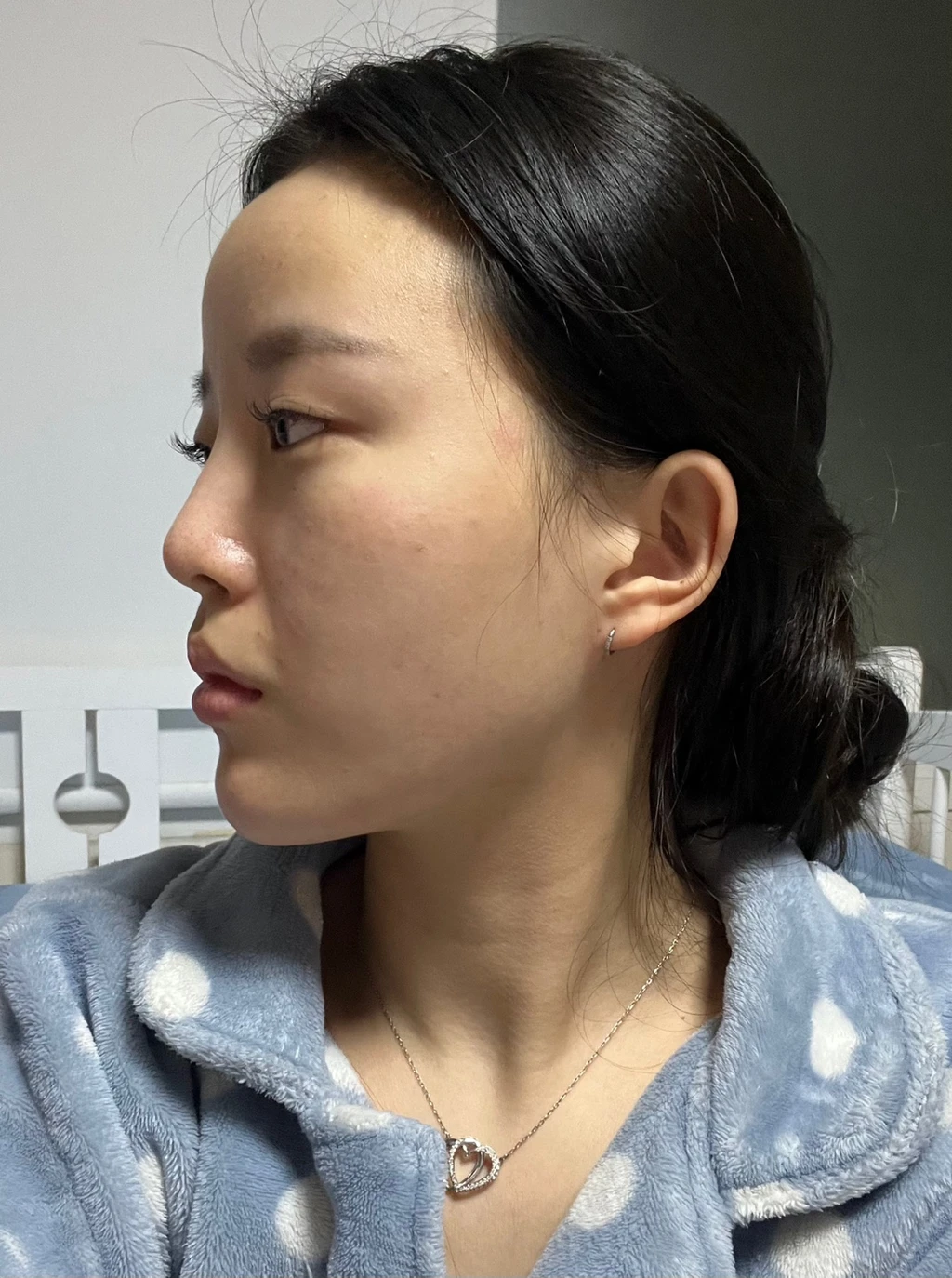 before_image
