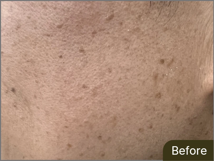 before_image