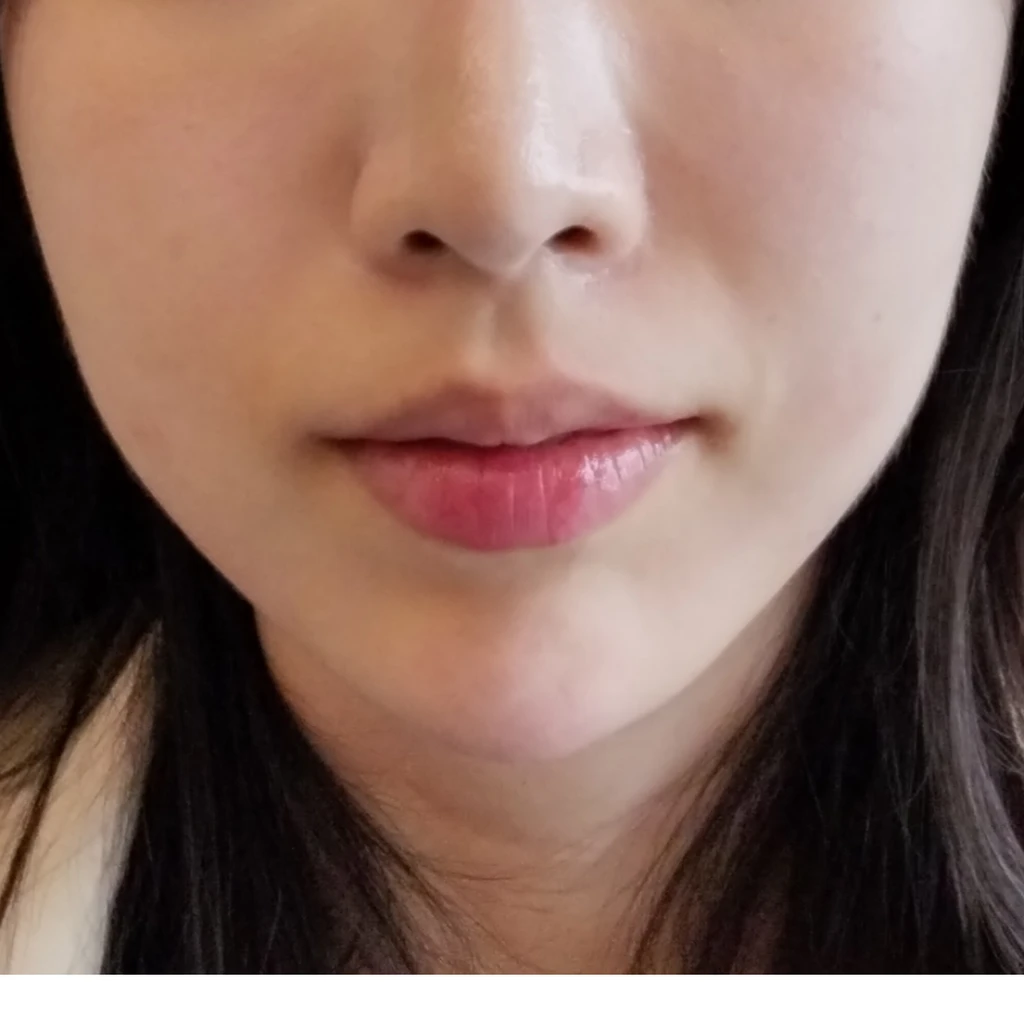 before_image