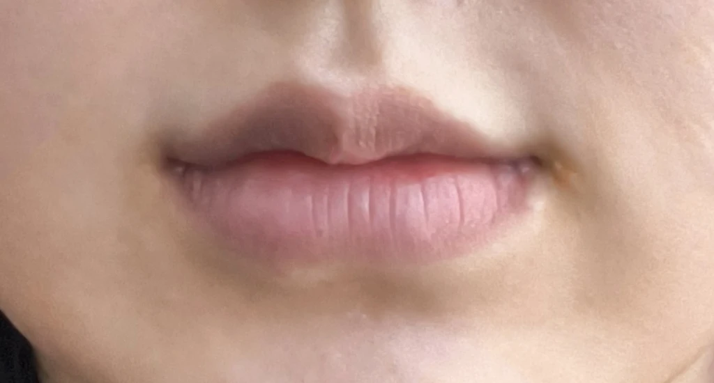 before_image