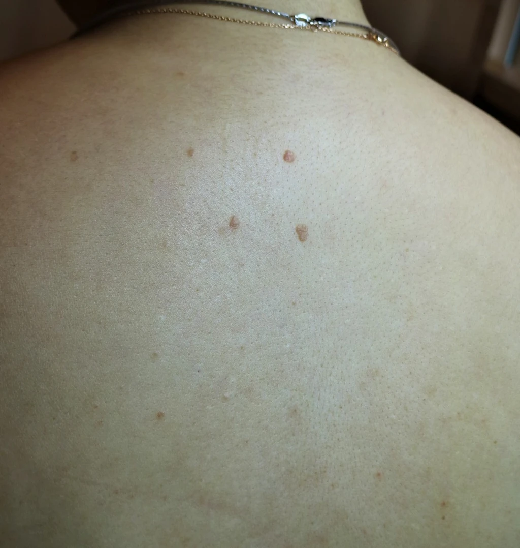 before_image