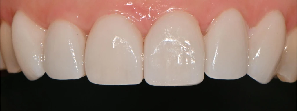 before_image