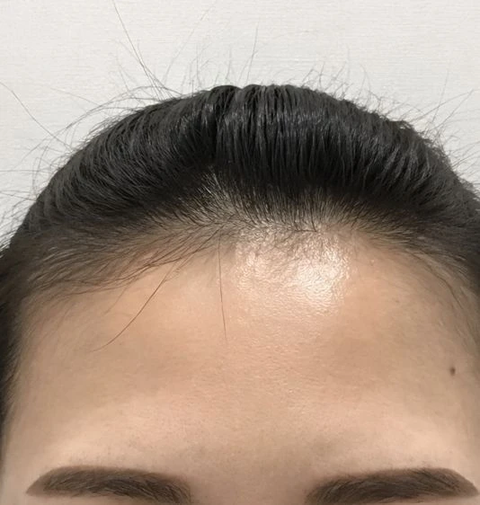 before_image