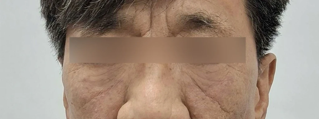before_image