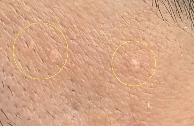 before_image