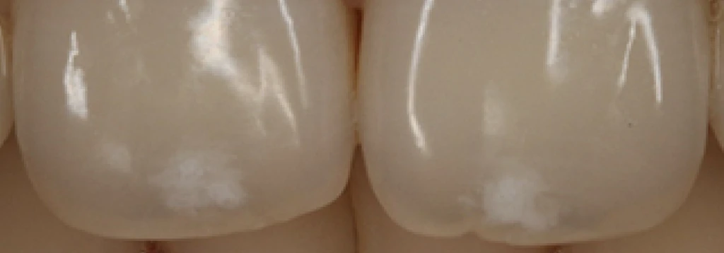 before_image