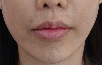 before_image
