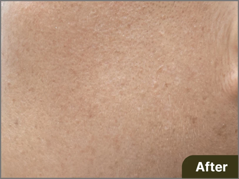 before_image