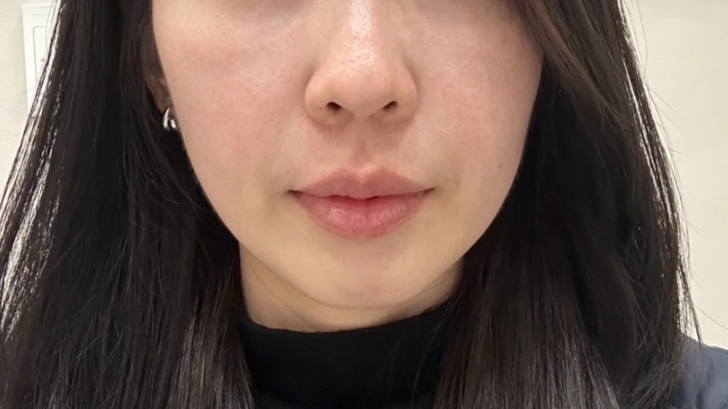 before_image