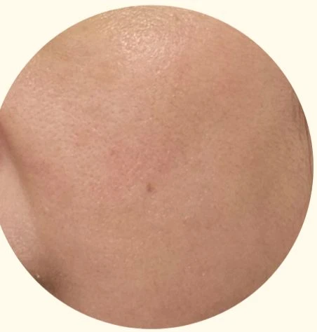 before_image