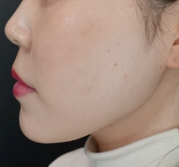 before_image