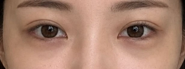 before_image