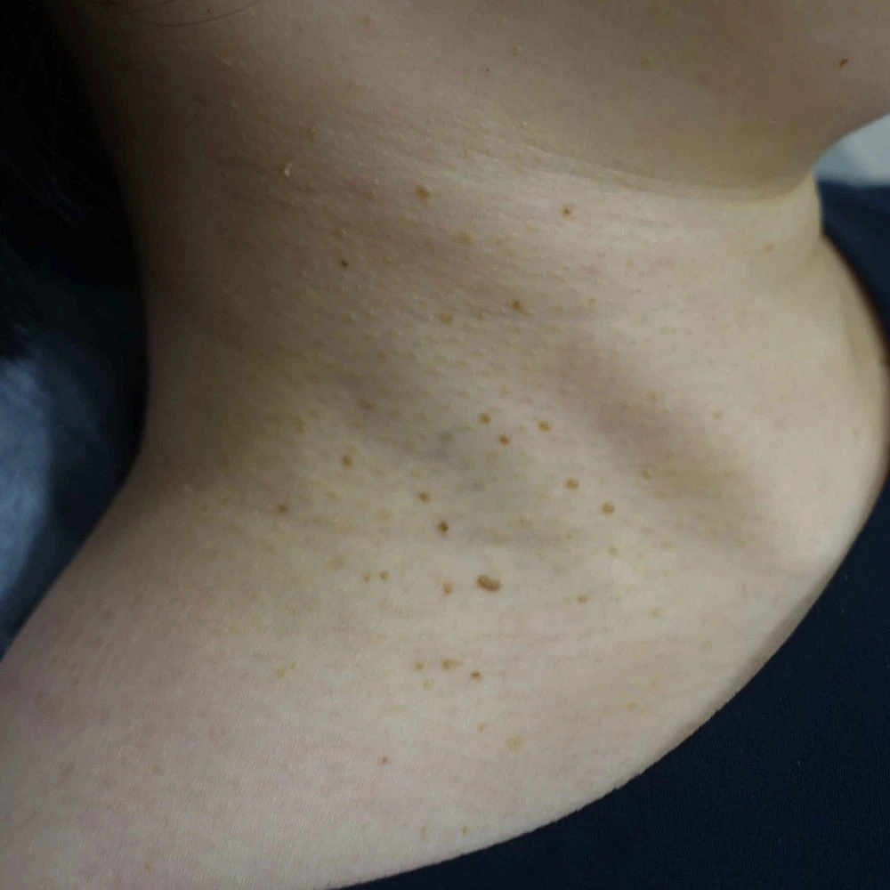 before_image