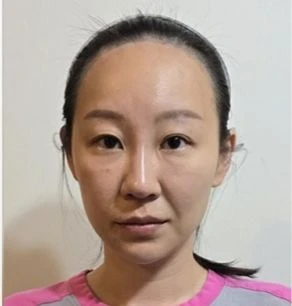 before_image